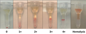 Do You Know Your Horse’s Blood Type? A, C, D, K, P, Q, Or U? | Equine ...