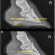 Managing Thin Soles in Performance Horses